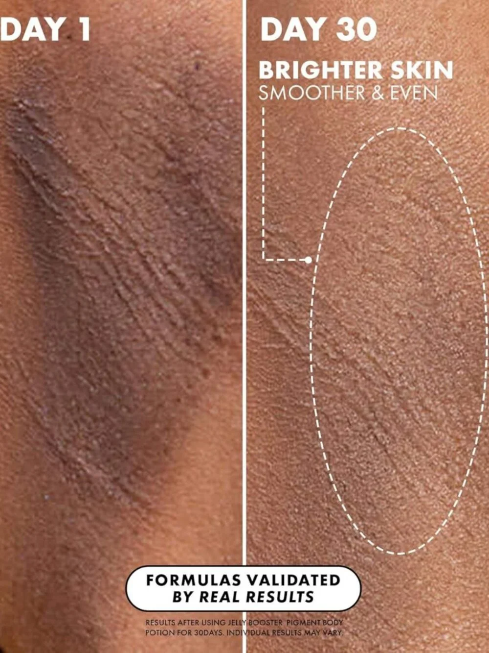 Jelly Booster Pigment Body Potion | Dark Spot Remover & Skin Brightener